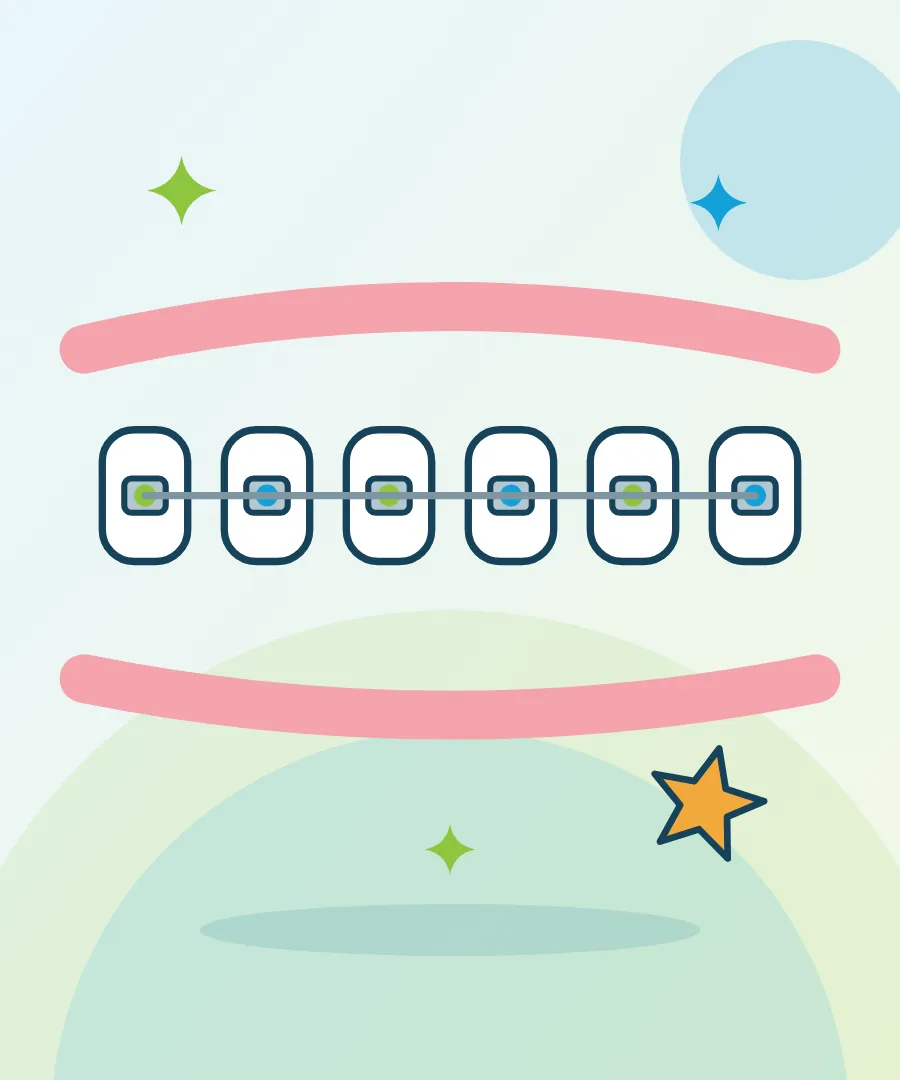 Illustration of braces with coloured bands on a child's teeth for braces for kids at Sai Multi Speciality Dental Clinic, Baner