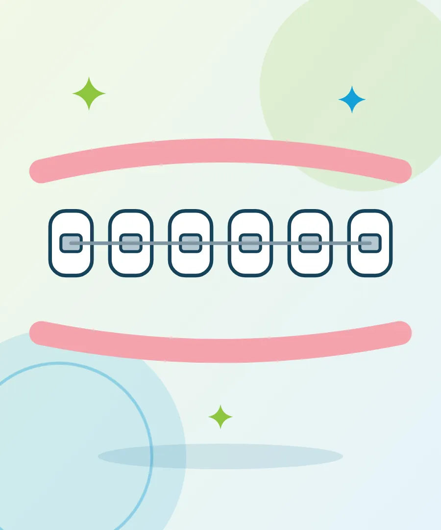 Illustration of braces and a wire on a row of teeth for braces treatment at Sai Multi Speciality Dental Clinic, Baner