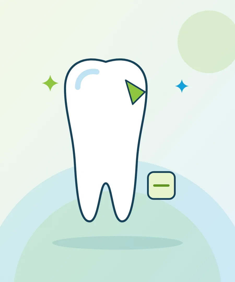 Illustration of a chipped tooth repaired with bonding for dental bonding at Sai Multi Speciality Dental Clinic, Baner