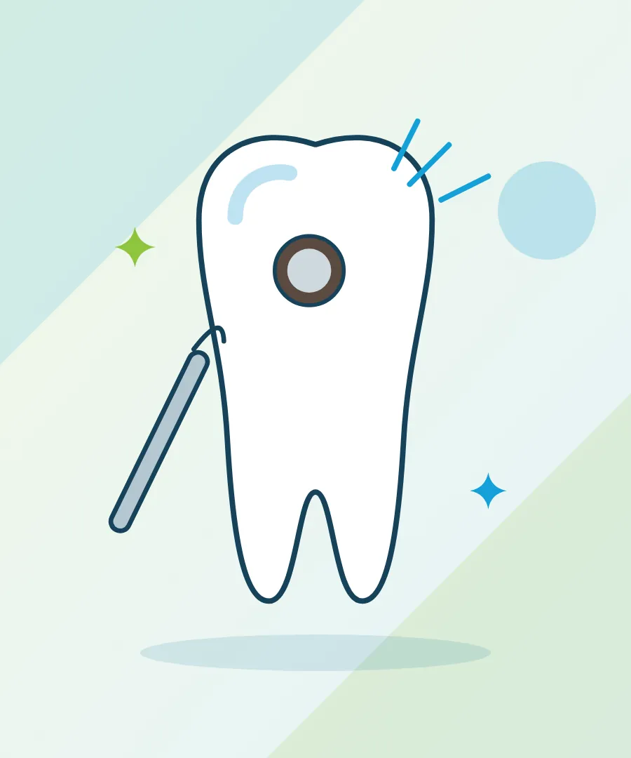 Illustration of a tooth with a cavity and a filling for dental fillings at Sai Multi Speciality Dental Clinic, Baner