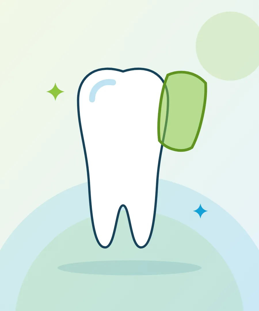 Illustration of a thin veneer shell over a tooth for dental veneers at Sai Multi Speciality Dental Clinic, Baner