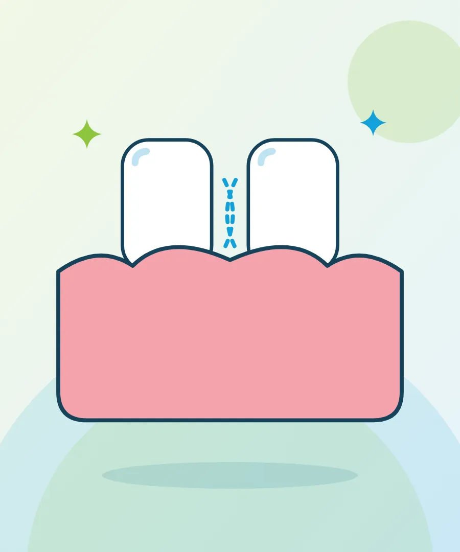 Illustration of two teeth with movement lines for loose teeth at Sai Multi Speciality Dental Clinic, Baner