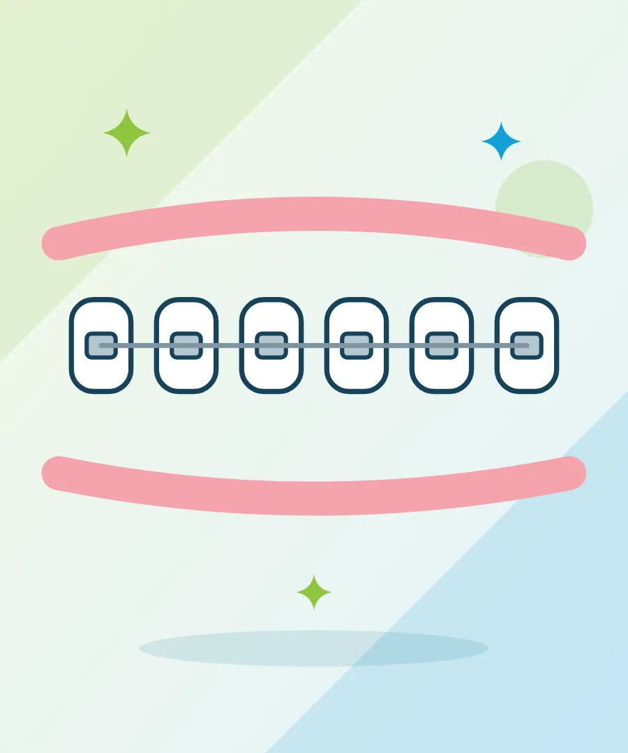 Illustration of braces and a wire on a row of teeth for orthodontist at Sai Multi Speciality Dental Clinic, Baner