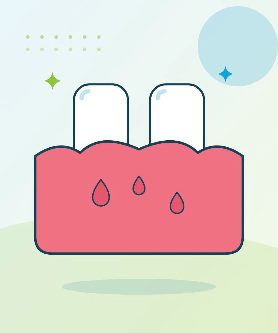 Illustration of swollen gums around two teeth for swollen gums at Sai Multi Speciality Dental Clinic, Baner